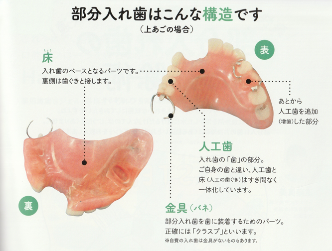 部分入れ歯のお掃除の仕方